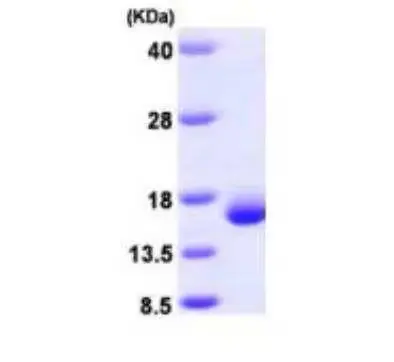 Recombinant Human Galectin 2, His Tag -25 ug