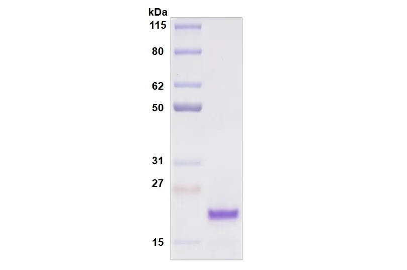Recombinant Human Siglec-8, His Tag -25 ug